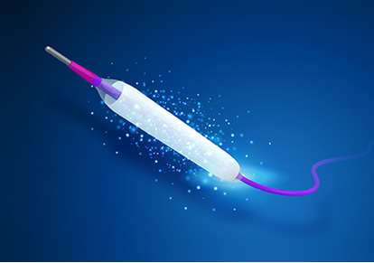 轻舟?冠脉药物输送系统