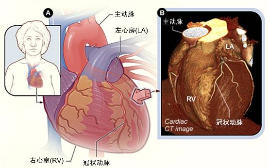 冠心病需要做哪些检查？(图2)