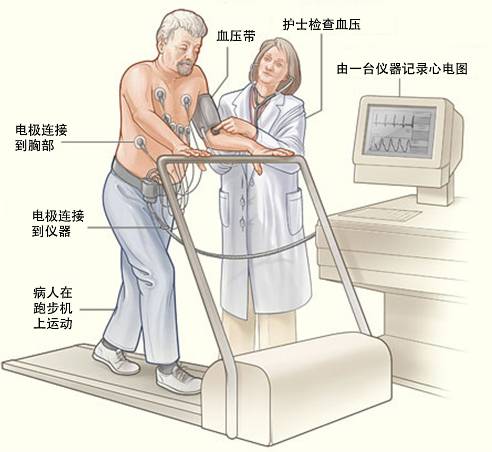 冠心病需要做哪些检查？(图3)