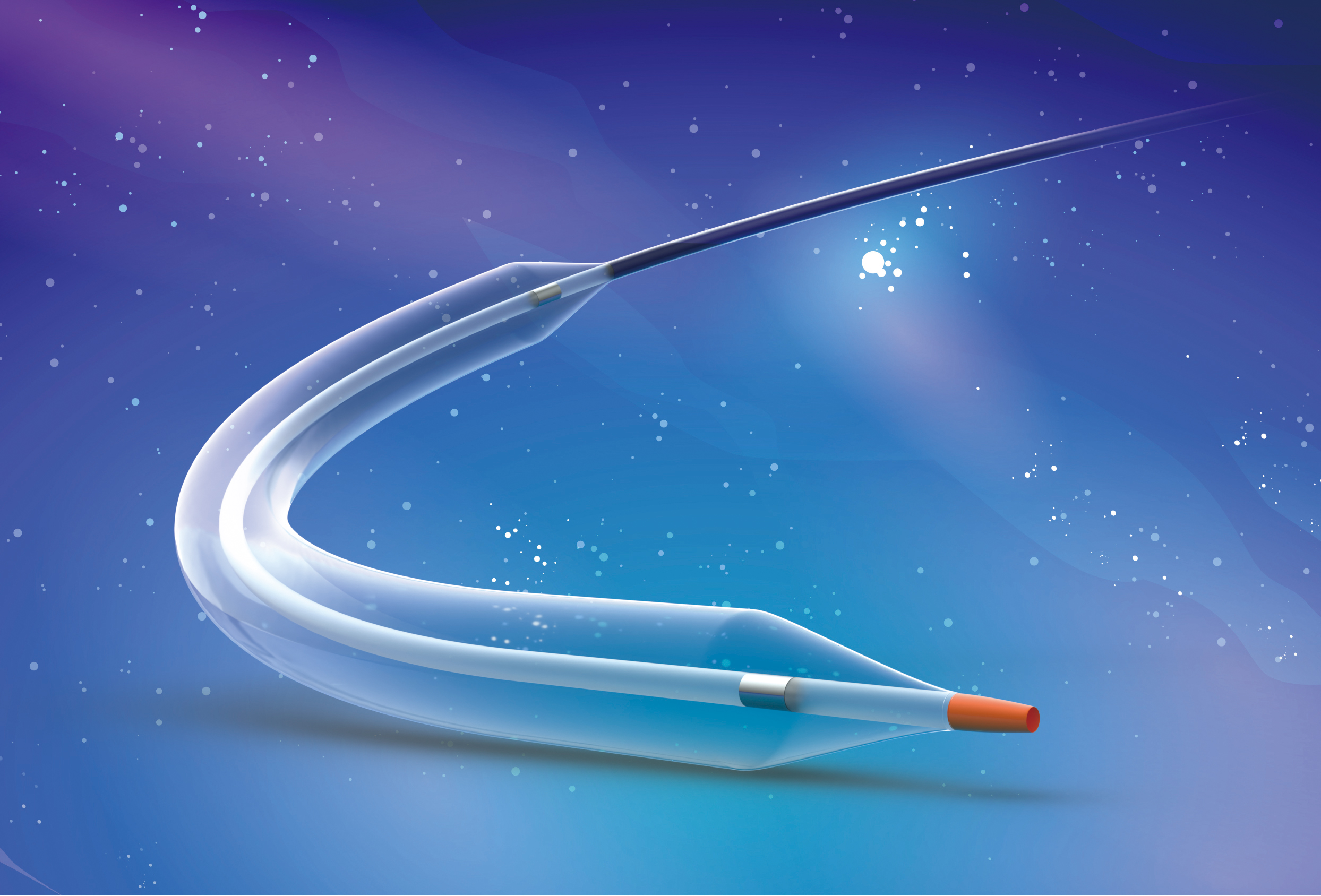 周游? Voyaging?球囊扩张导管