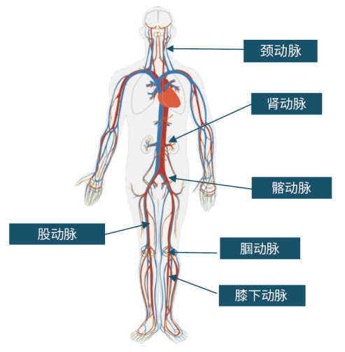 禄游?Luvjour 外周球囊扩张导管(图2)